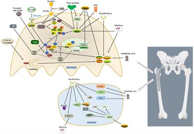Mechanism of regulating macrophages/osteoclasts in attenuating wear particle-induced aseptic osteolysis